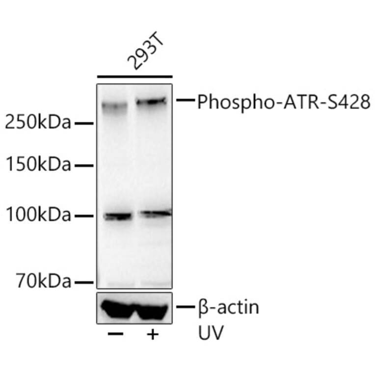 Western Blot - Anti-ATR (phospho Ser428) Antibody [ARC55118] (A306035) - Antibodies.com