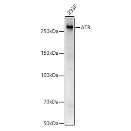 Western Blot - Anti-ATR Antibody [ARC53816] (A306036) - Antibodies.com