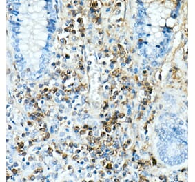 Immunohistochemistry - Anti-IL-17A Antibody [ARC52762] (A306037) - Antibodies.com