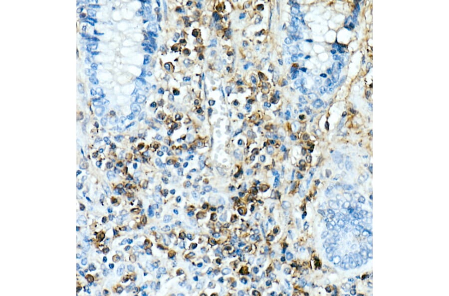 Immunohistochemistry - Anti-IL-17A Antibody [ARC52762] (A306037) - Antibodies.com