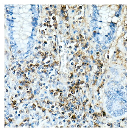 Immunohistochemistry - Anti-IL-17A Antibody [ARC52762] (A306037) - Antibodies.com