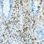 Immunohistochemistry - Anti-IL-17A Antibody [ARC52762] (A306037) - Antibodies.com