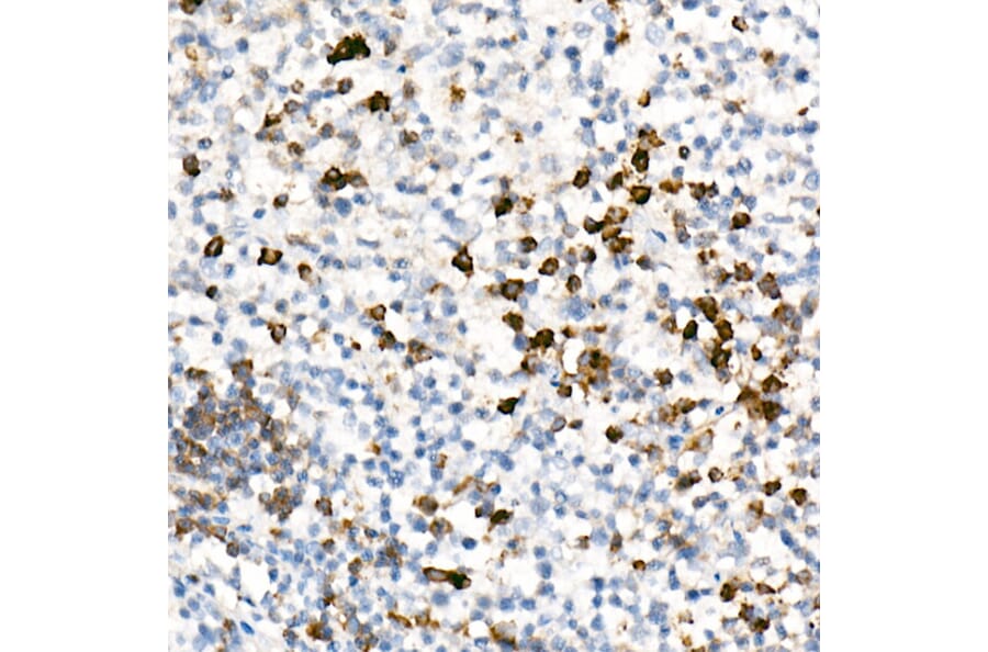 Immunohistochemistry - Anti-IL-17A Antibody [ARC52762] (A306037) - Antibodies.com