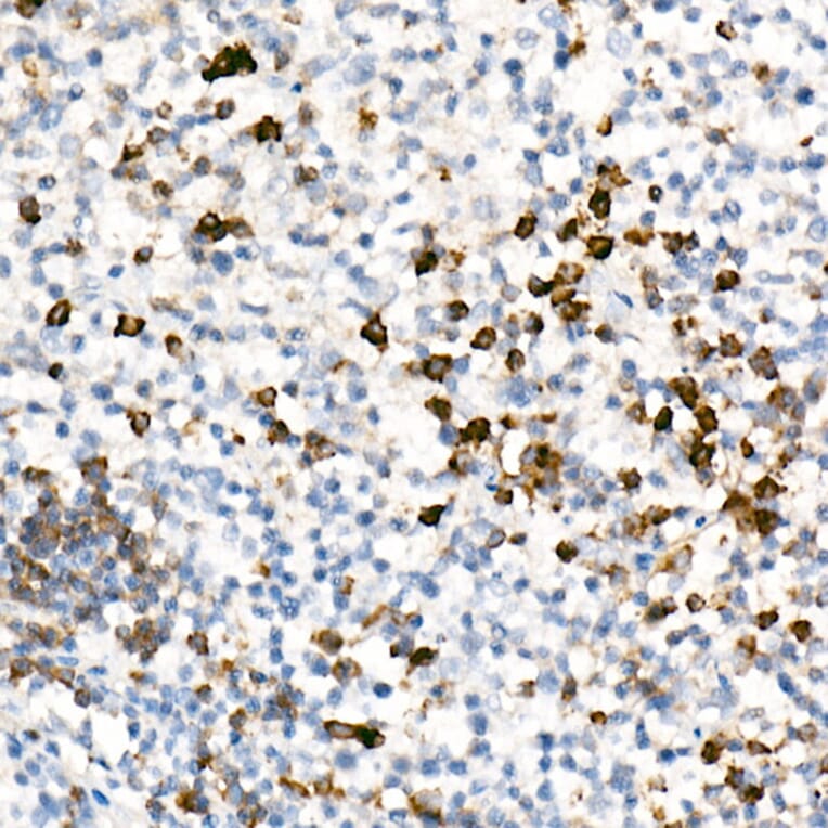 Immunohistochemistry - Anti-IL-17A Antibody [ARC52762] (A306037) - Antibodies.com