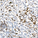 Immunohistochemistry - Anti-IL-17A Antibody [ARC52762] (A306037) - Antibodies.com