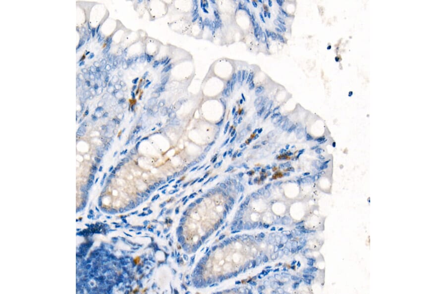 Immunohistochemistry - Anti-IL-17A Antibody [ARC52762] (A306037) - Antibodies.com