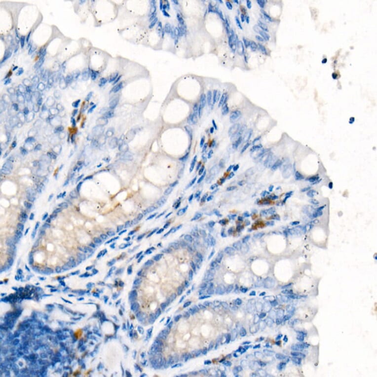 Immunohistochemistry - Anti-IL-17A Antibody [ARC52762] (A306037) - Antibodies.com