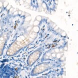 Immunohistochemistry - Anti-IL-17A Antibody [ARC52762] (A306037) - Antibodies.com