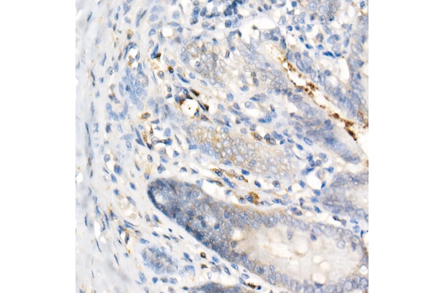 Immunohistochemistry - Anti-IL-17A Antibody [ARC52762] (A306037) - Antibodies.com