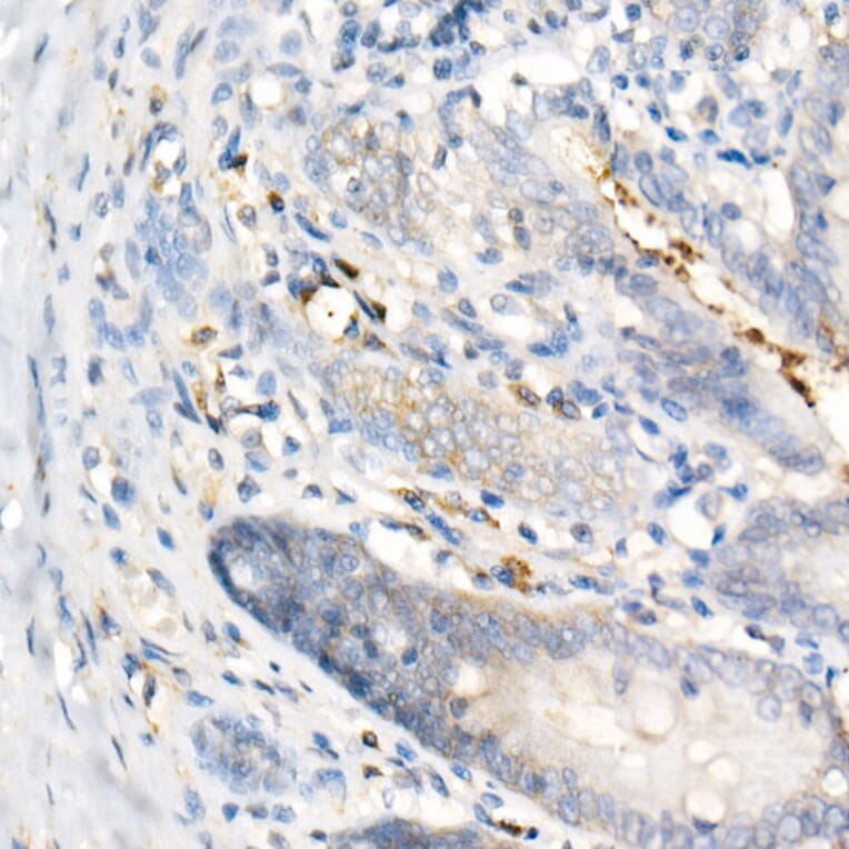 Immunohistochemistry - Anti-IL-17A Antibody [ARC52762] (A306037) - Antibodies.com