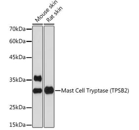 Western Blot - Anti-TPSB2 Antibody [ARC2328] (A306038) - Antibodies.com