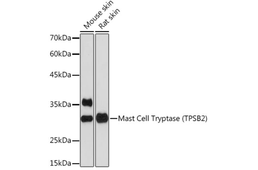Western Blot - Anti-TPSB2 Antibody [ARC2328] (A306038) - Antibodies.com