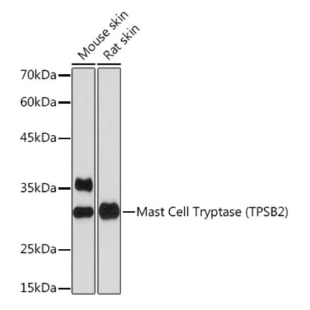 Western Blot - Anti-TPSB2 Antibody [ARC2328] (A306038) - Antibodies.com