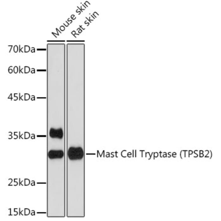 Western Blot - Anti-TPSB2 Antibody [ARC2328] (A306038) - Antibodies.com