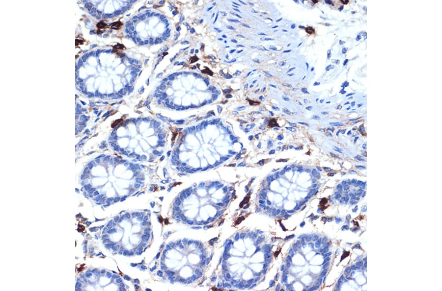 Immunohistochemistry - Anti-TPSB2 Antibody [ARC2328] (A306038) - Antibodies.com