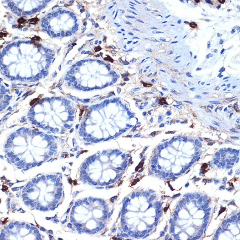 Immunohistochemistry - Anti-TPSB2 Antibody [ARC2328] (A306038) - Antibodies.com