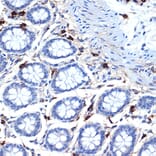 Immunohistochemistry - Anti-TPSB2 Antibody [ARC2328] (A306038) - Antibodies.com