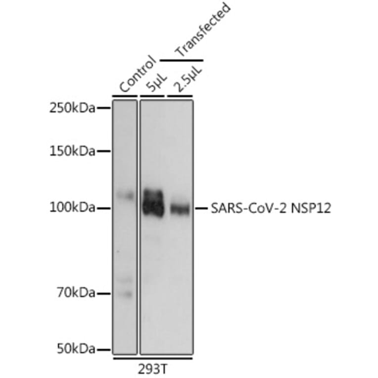 Western Blot - Anti-SARS-CoV2 NSP12 Antibody (A306039) - Antibodies.com