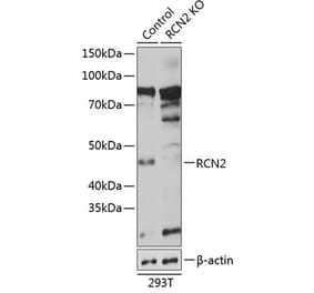 Western Blot - Anti-RCN2 Antibody (A306040) - Antibodies.com