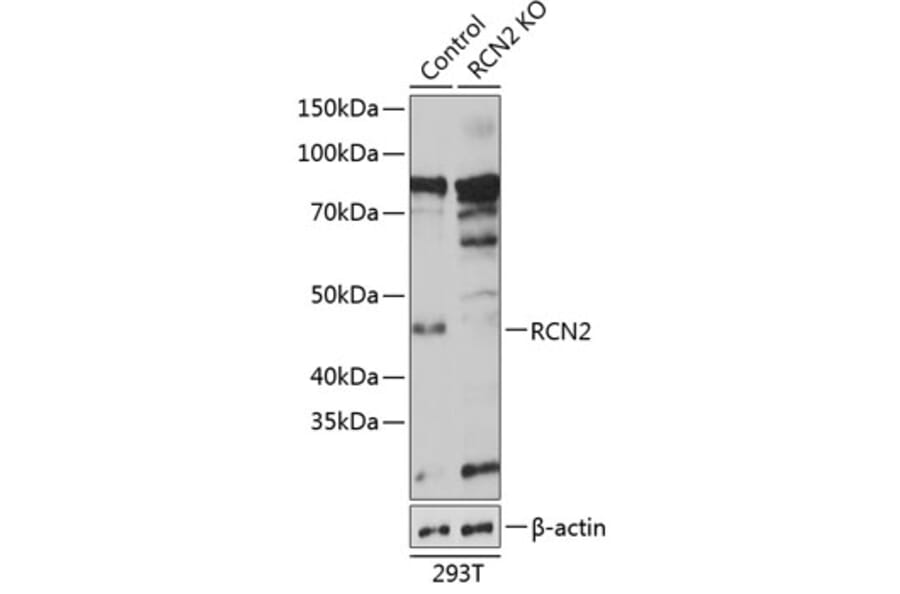 Western Blot - Anti-RCN2 Antibody (A306040) - Antibodies.com