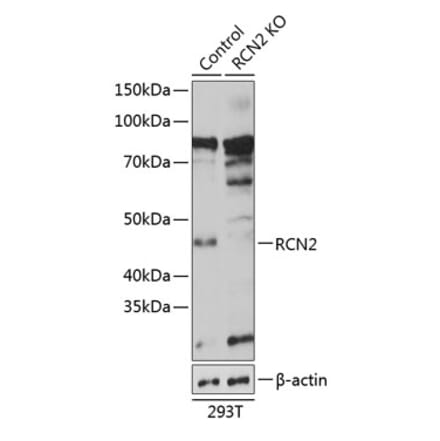 Western Blot - Anti-RCN2 Antibody (A306040) - Antibodies.com