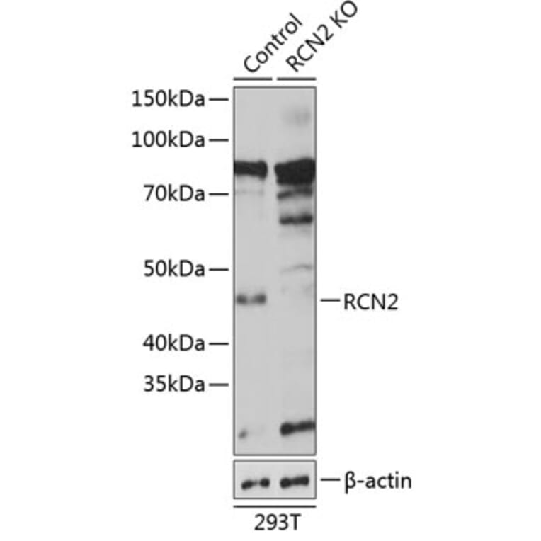 Western Blot - Anti-RCN2 Antibody (A306040) - Antibodies.com