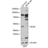 Western Blot - Anti-RCN2 Antibody (A306040) - Antibodies.com