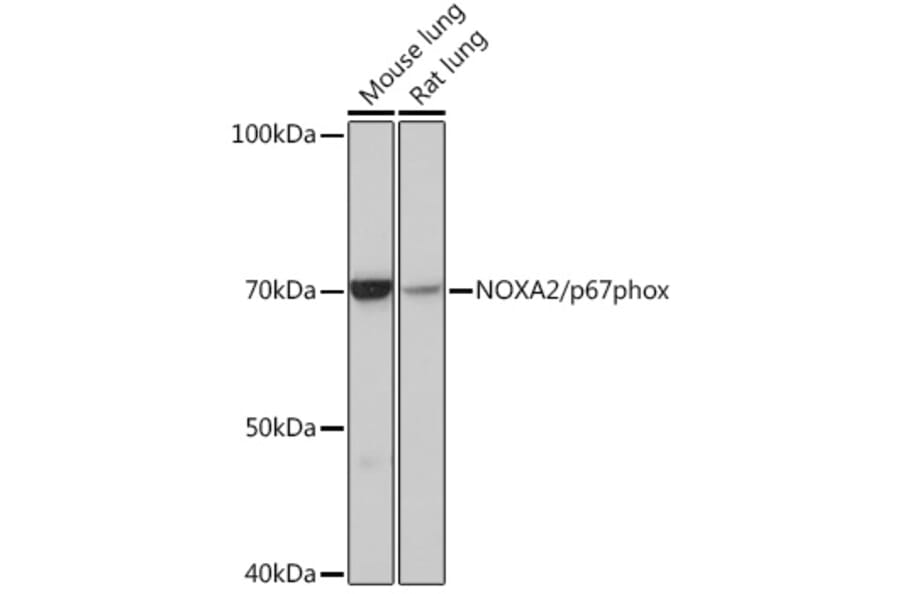 Western Blot - Anti-NOXA2/p67phox Antibody [ARC0828] (A306041) - Antibodies.com