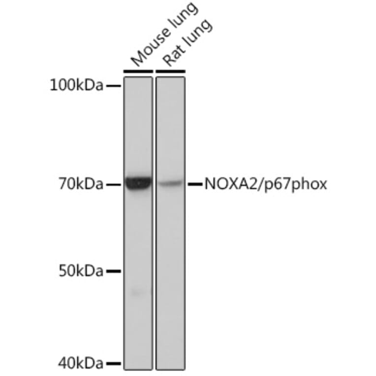 Western Blot - Anti-NOXA2/p67phox Antibody [ARC0828] (A306041) - Antibodies.com