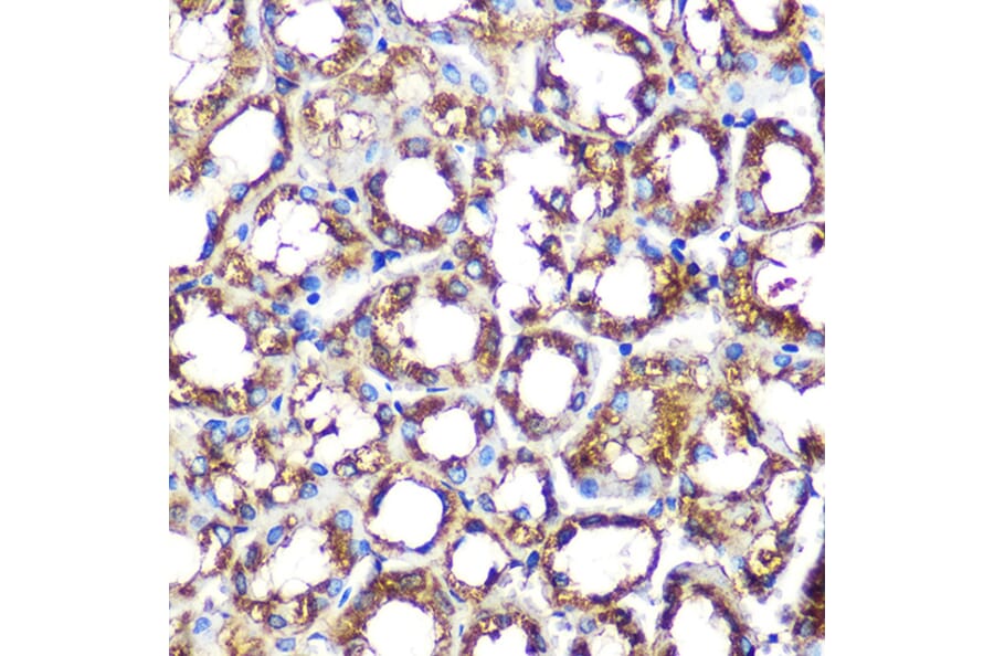 Immunohistochemistry - Anti-NOXA2/p67phox Antibody [ARC0828] (A306041) - Antibodies.com