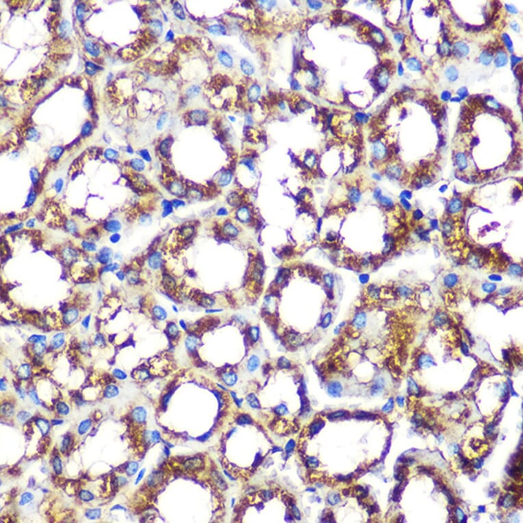 Immunohistochemistry - Anti-NOXA2/p67phox Antibody [ARC0828] (A306041) - Antibodies.com