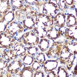 Immunohistochemistry - Anti-NOXA2/p67phox Antibody [ARC0828] (A306041) - Antibodies.com