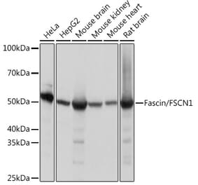 Western Blot - Anti-Fascin Antibody [ARC1638] (A306042) - Antibodies.com