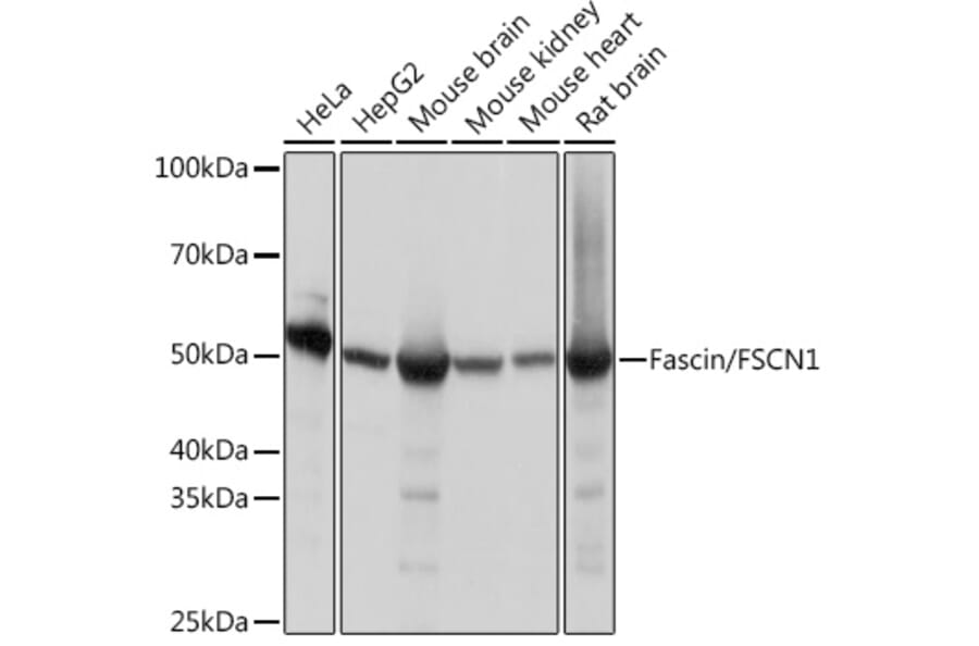 Western Blot - Anti-Fascin Antibody [ARC1638] (A306042) - Antibodies.com