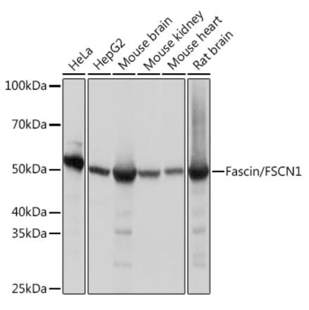 Western Blot - Anti-Fascin Antibody [ARC1638] (A306042) - Antibodies.com