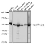 Western Blot - Anti-Fascin Antibody [ARC1638] (A306042) - Antibodies.com