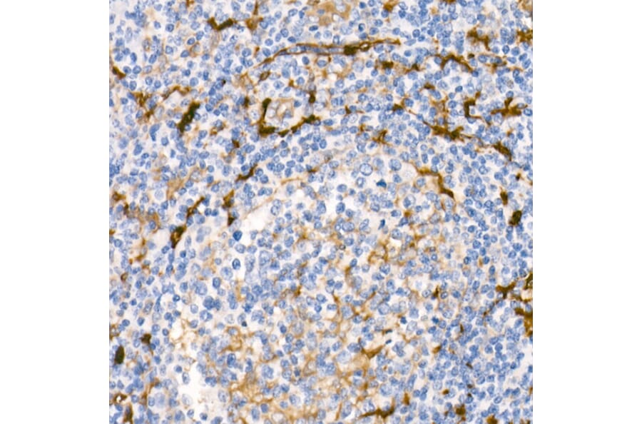 Immunohistochemistry - Anti-Fascin Antibody [ARC1638] (A306042) - Antibodies.com