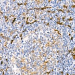 Immunohistochemistry - Anti-Fascin Antibody [ARC1638] (A306042) - Antibodies.com