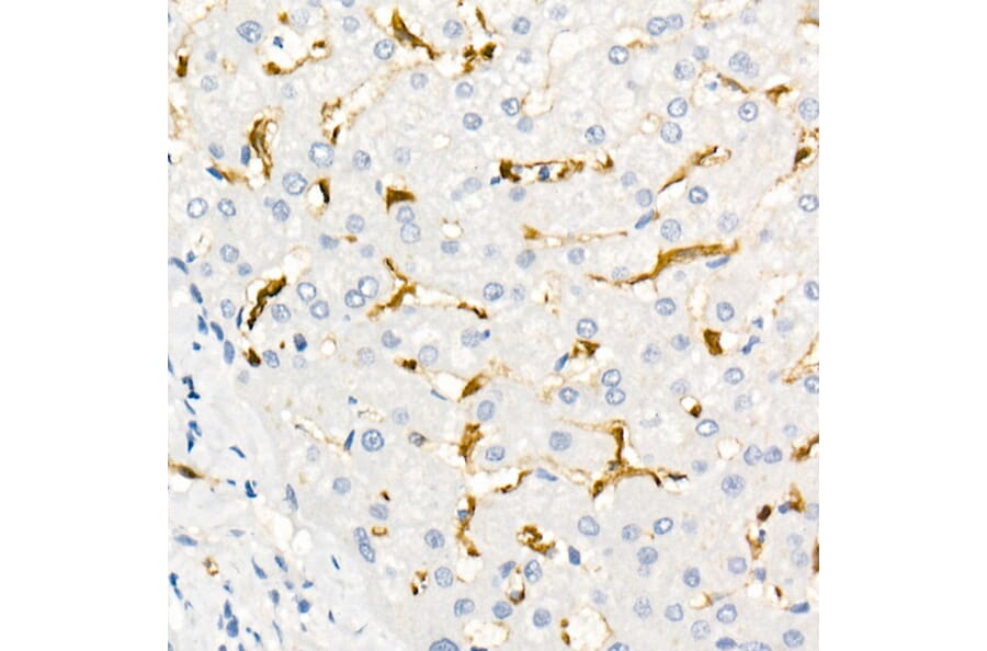 Immunohistochemistry - Anti-Fascin Antibody [ARC1638] (A306042) - Antibodies.com