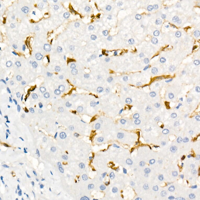 Immunohistochemistry - Anti-Fascin Antibody [ARC1638] (A306042) - Antibodies.com