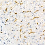 Immunohistochemistry - Anti-Fascin Antibody [ARC1638] (A306042) - Antibodies.com