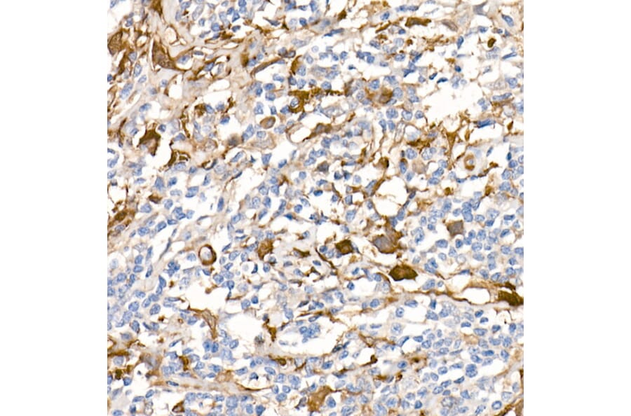 Immunohistochemistry - Anti-Fascin Antibody [ARC1638] (A306042) - Antibodies.com