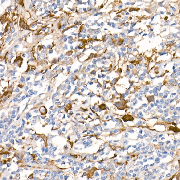 Immunohistochemistry - Anti-Fascin Antibody [ARC1638] (A306042) - Antibodies.com