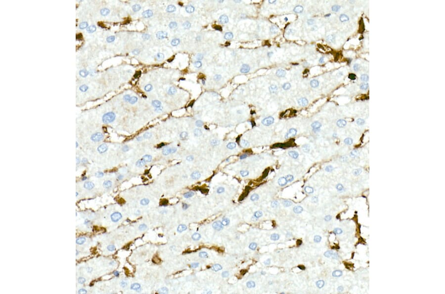 Immunohistochemistry - Anti-Fascin Antibody [ARC1638] (A306042) - Antibodies.com