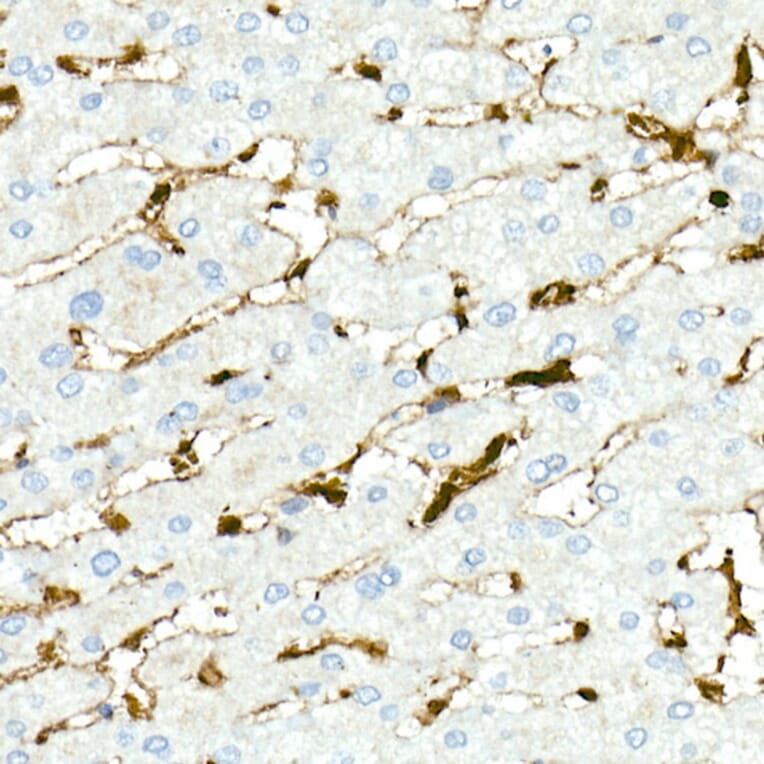 Immunohistochemistry - Anti-Fascin Antibody [ARC1638] (A306042) - Antibodies.com