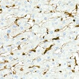 Immunohistochemistry - Anti-Fascin Antibody [ARC1638] (A306042) - Antibodies.com