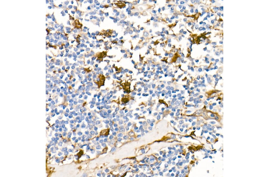 Immunohistochemistry - Anti-Fascin Antibody [ARC1638] (A306042) - Antibodies.com