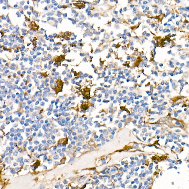 Immunohistochemistry - Anti-Fascin Antibody [ARC1638] (A306042) - Antibodies.com