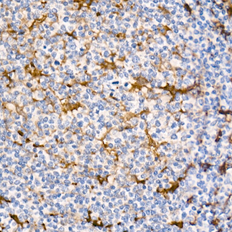 Immunohistochemistry - Anti-Fascin Antibody [ARC1638] (A306042) - Antibodies.com