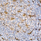 Immunohistochemistry - Anti-Fascin Antibody [ARC1638] (A306042) - Antibodies.com